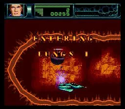 Rex Ronan: Experimental Surgeon (SNES)